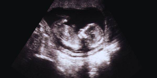 alt="jornada inicial de Lucas ultrassom"